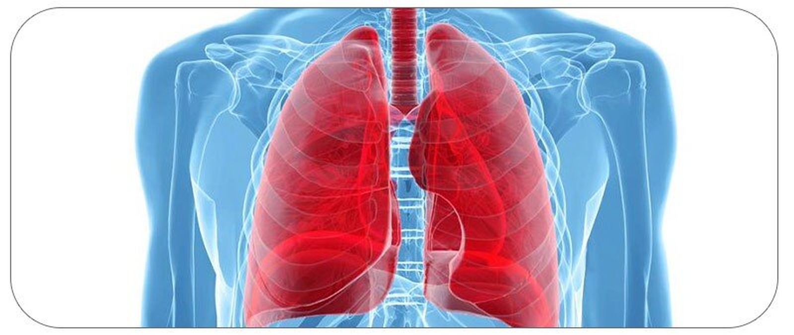 باروترومای ریه چیست؟